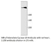 Adenylate Cyclase 10 Antibody