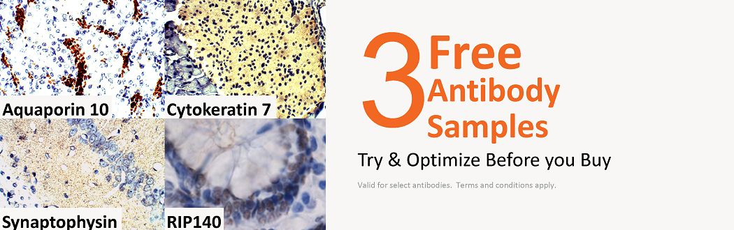 Free_Antibody_Samples